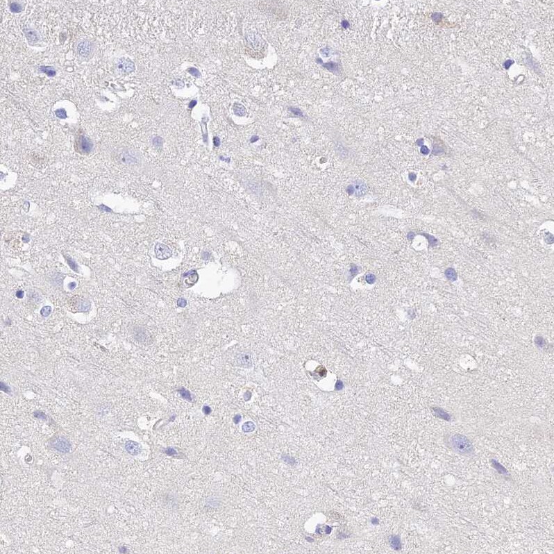 MS4A5 Antibody - BSA Free Immunohistochemistry: MS4A5 Antibody - BSA Free [NBP1-92143]