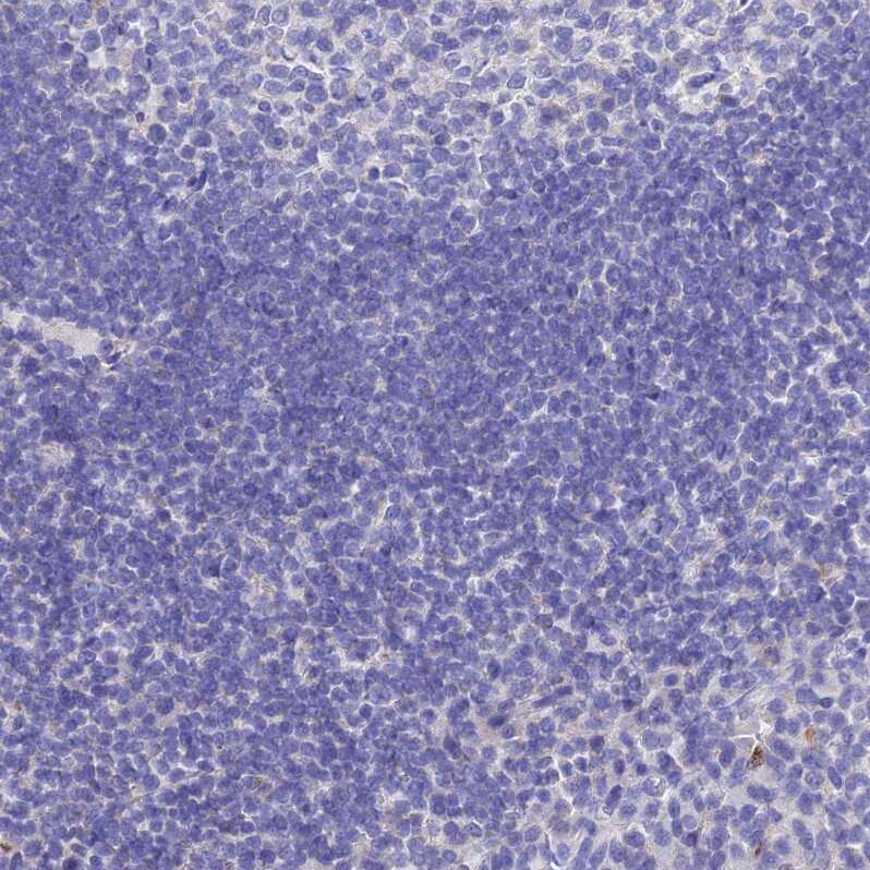 MS4A5 Antibody - BSA Free Immunohistochemistry: MS4A5 Antibody - BSA Free [NBP1-92143]