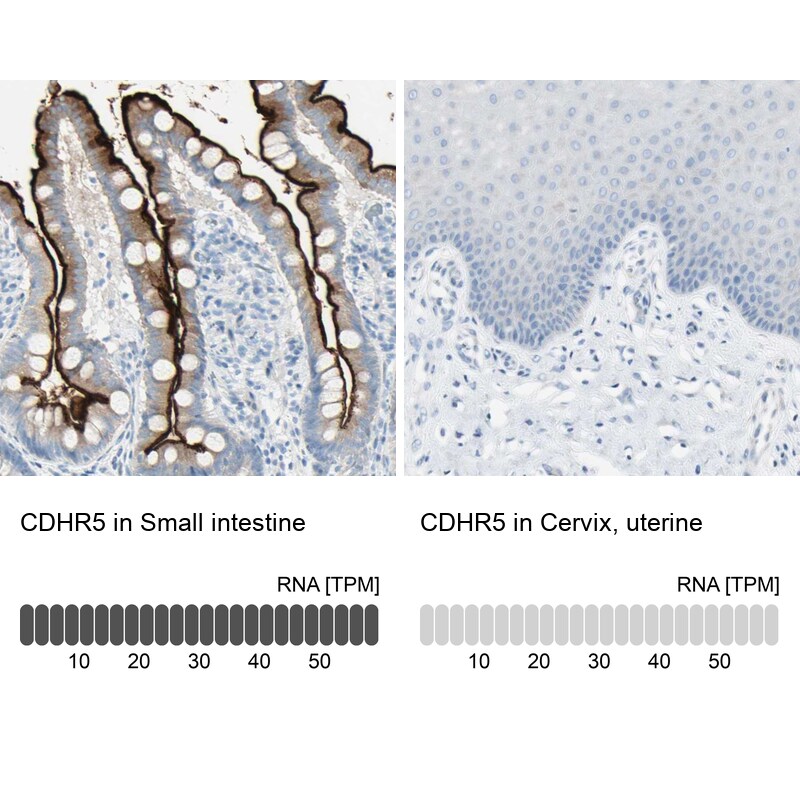 MUCDHL Antibody - BSA Free Immunohistochemistry: MUCDHL Antibody - BSA Free [NBP1-92148]