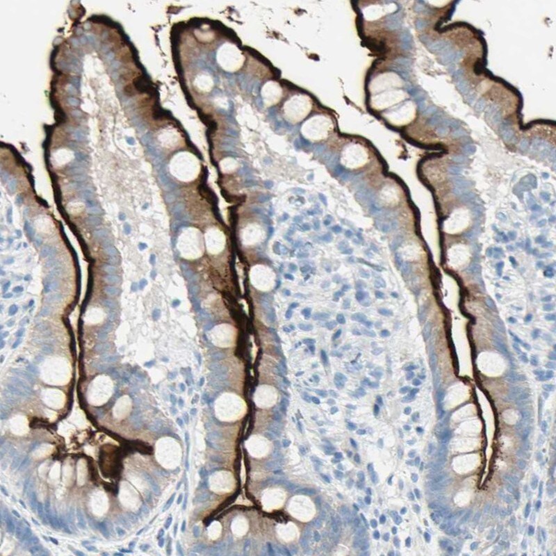 MUCDHL Antibody - BSA Free Immunohistochemistry: MUCDHL Antibody - BSA Free [NBP1-92148]