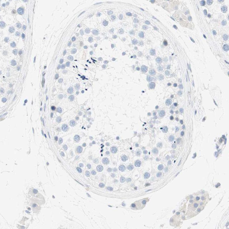 MUCDHL Antibody - BSA Free Immunohistochemistry-Paraffin: MUCDHL Antibody [NBP1-92149]