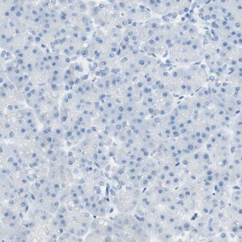 MUCDHL Antibody - BSA Free Immunohistochemistry: MUCDHL Antibody - BSA Free [NBP1-92149]
