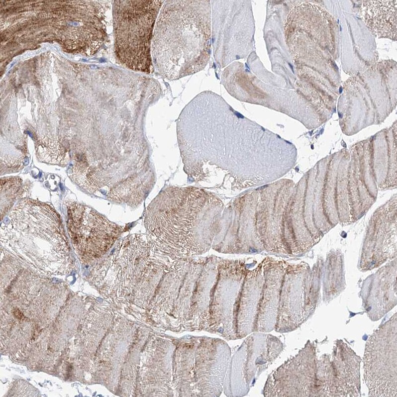 MURF2 Antibody - BSA Free Immunohistochemistry: MURF2 Antibody - BSA Free [NBP1-92153]