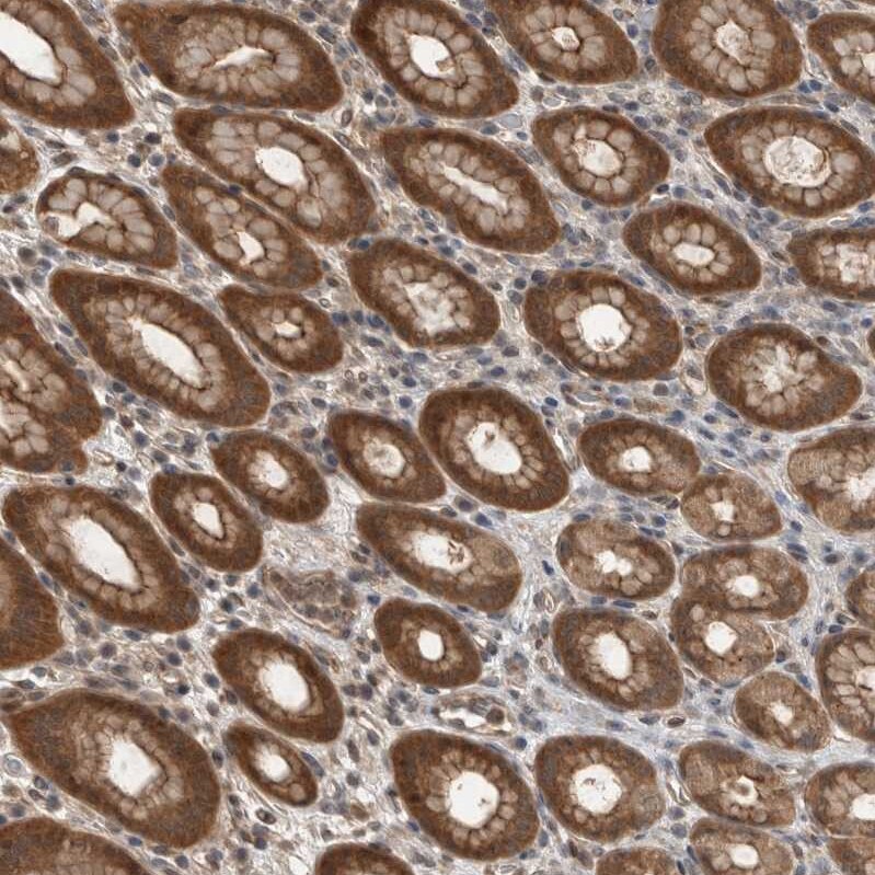 Myosin 1E Antibody - BSA Free Immunohistochemistry: Myosin 1E Antibody - BSA Free [NBP1-92158]