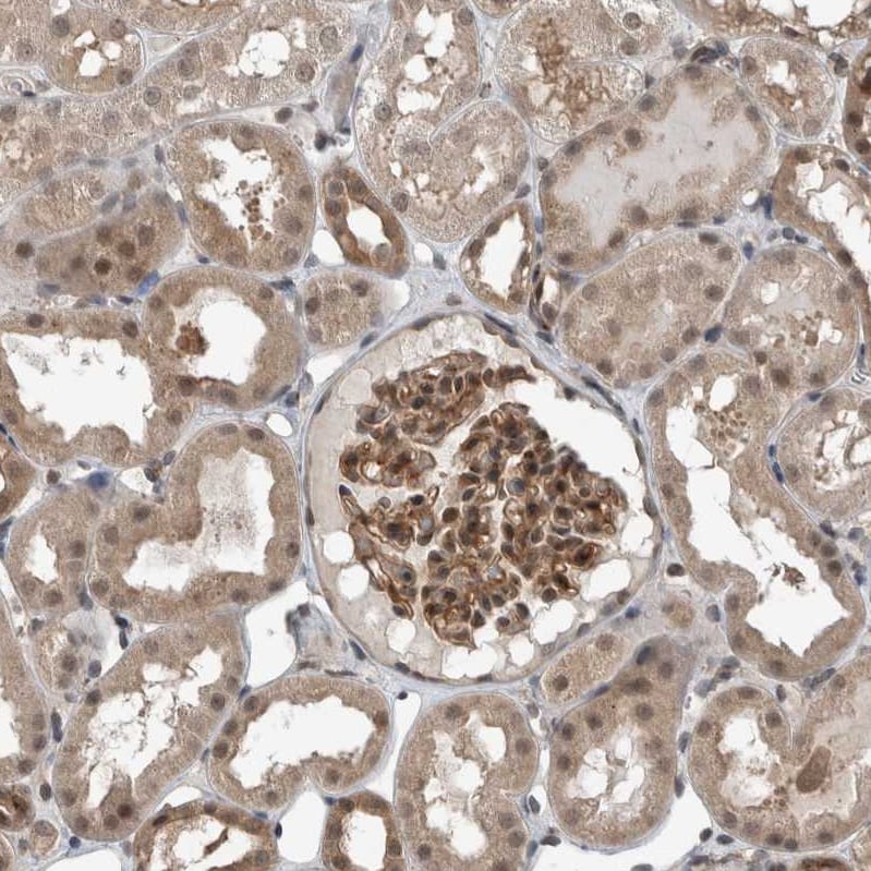 Myosin 1E Antibody - BSA Free Immunohistochemistry: Myosin 1E Antibody - BSA Free [NBP1-92158]