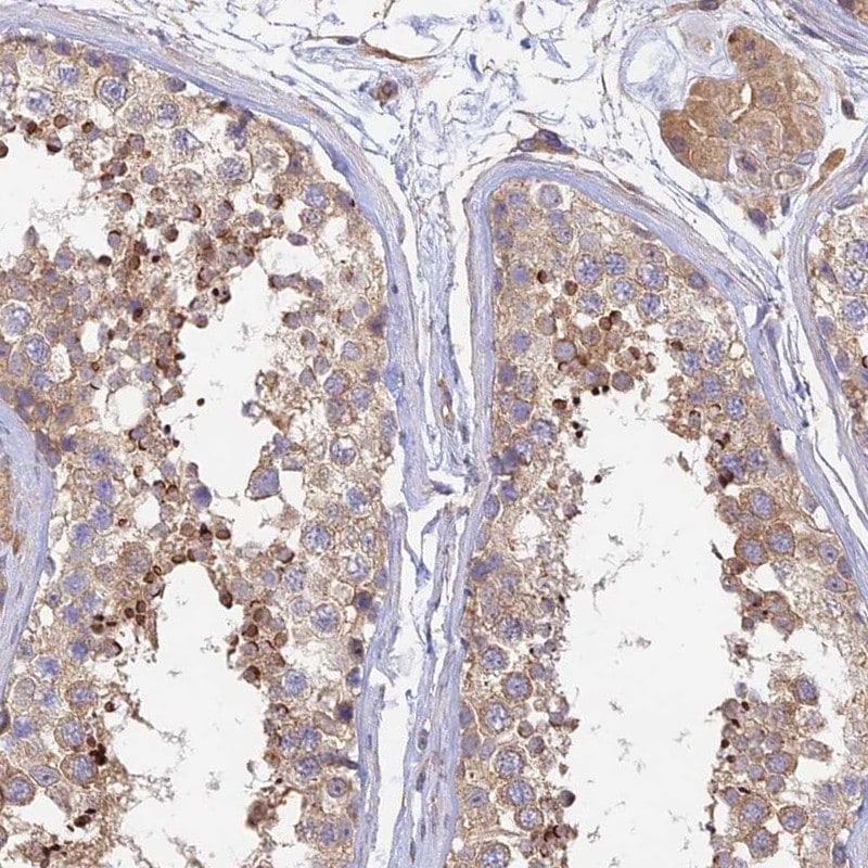Myosin IXA Antibody - BSA Free Immunohistochemistry: Myosin IXA Antibody - BSA Free [NBP1-92159]