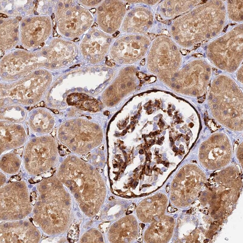 Myosin IXA Antibody - BSA Free Immunohistochemistry: Myosin IXA Antibody - BSA Free [NBP1-92160]
