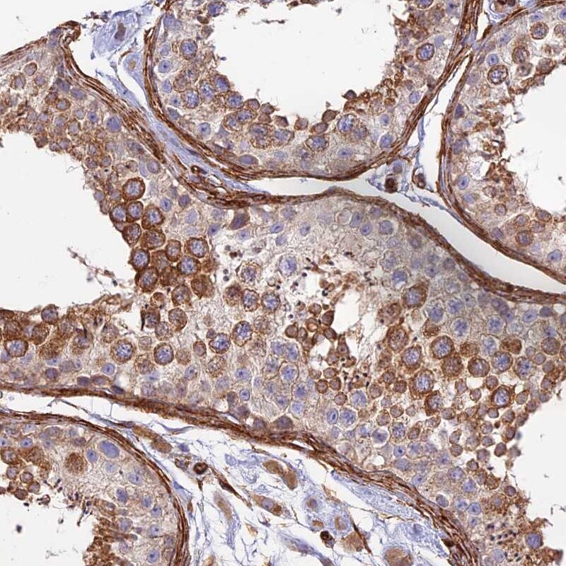 Myosin IXA Antibody - BSA Free Immunohistochemistry: Myosin IXA Antibody - BSA Free [NBP1-92160]