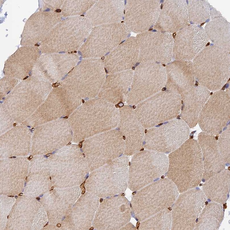 Myosin IXA Antibody - BSA Free Immunohistochemistry: Myosin IXA Antibody - BSA Free [NBP1-92160]