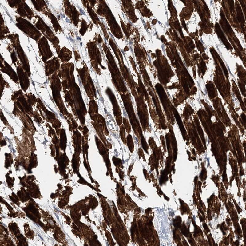NAG Antibody - BSA Free Immunohistochemistry-Paraffin: NAG Antibody [NBP1-92164]