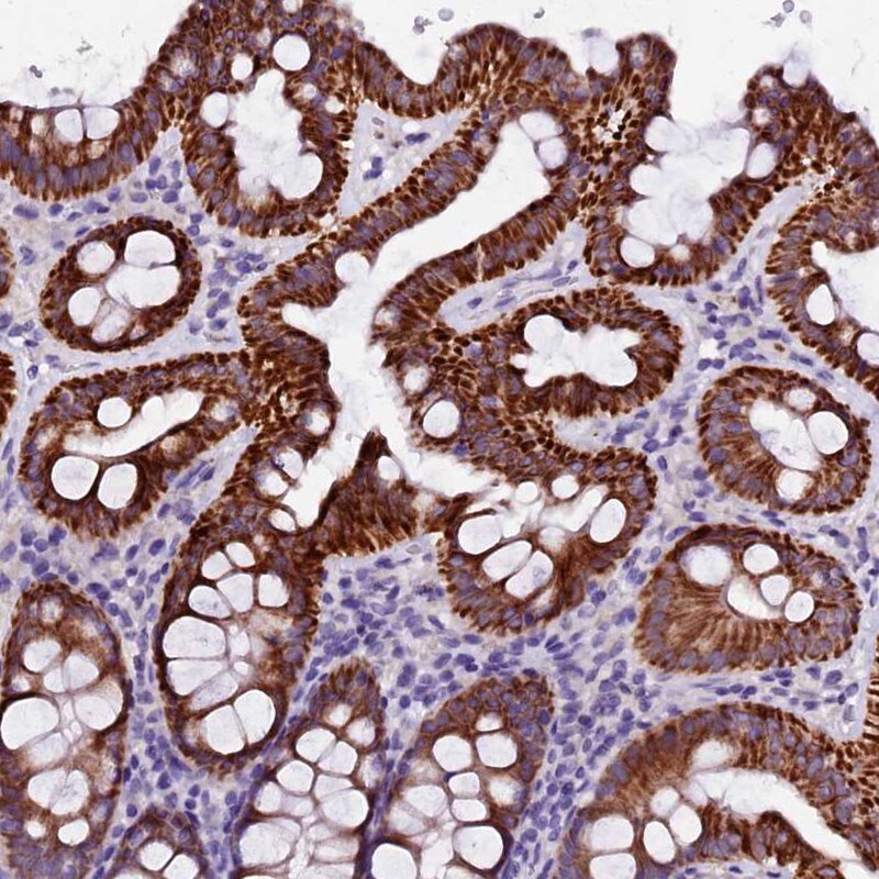 NARG1L Antibody - BSA Free Immunohistochemistry-Paraffin: NARG1L Antibody [NBP1-92166]