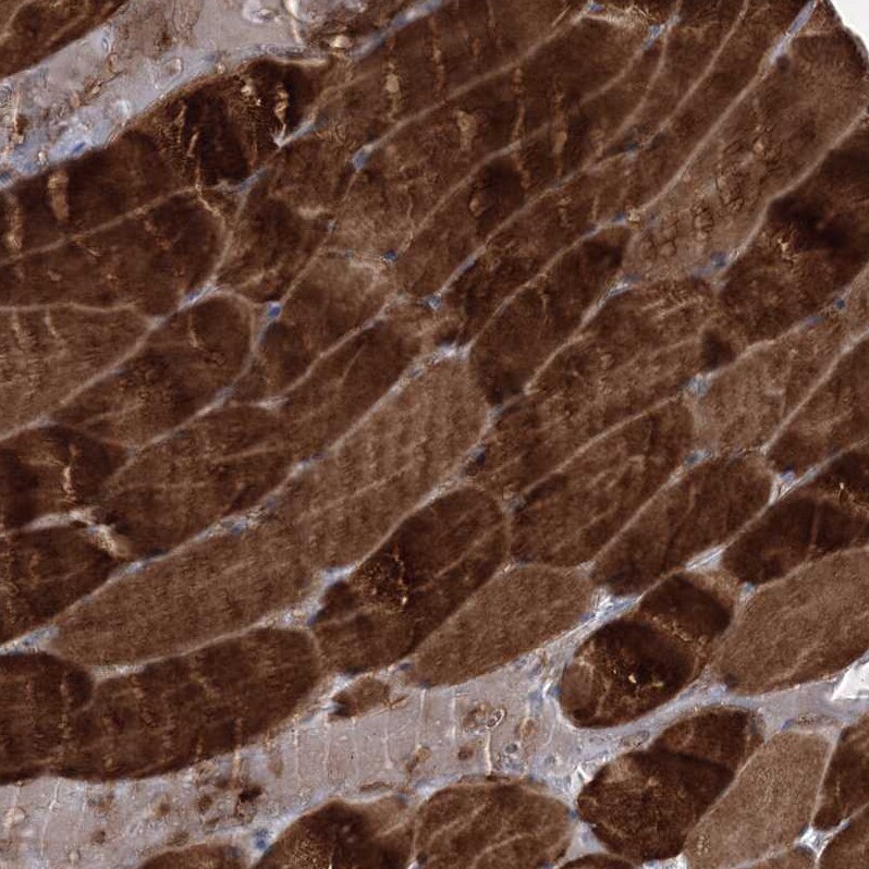 NAT11 Antibody - BSA Free Immunohistochemistry: NAT11 Antibody - BSA Free [NBP1-92168]