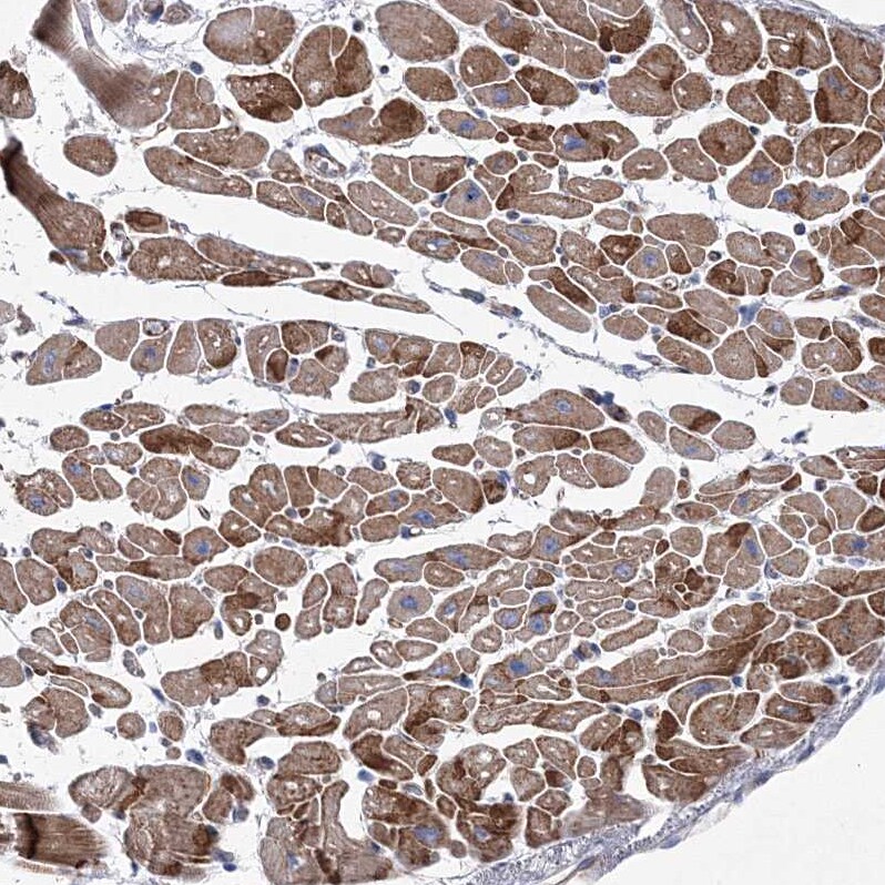 NAT11 Antibody - BSA Free Immunohistochemistry: NAT11 Antibody - BSA Free [NBP1-92168]