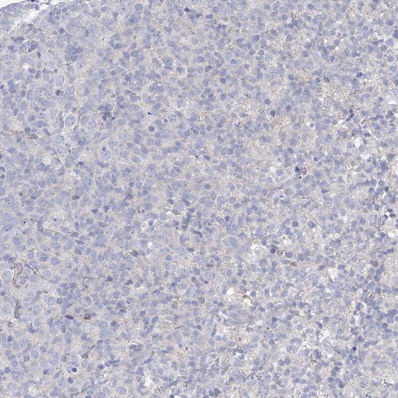 NAT11 Antibody - BSA Free Immunohistochemistry: NAT11 Antibody - BSA Free [NBP1-92168]