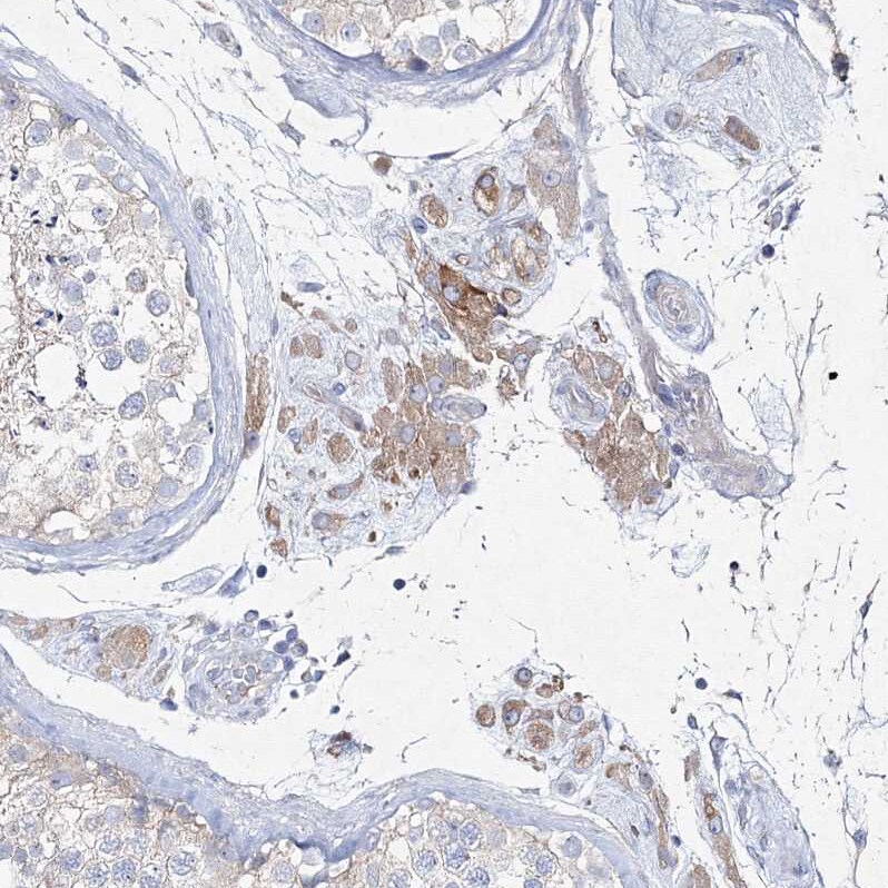 NAT11 Antibody - BSA Free Immunohistochemistry: NAT11 Antibody - BSA Free [NBP1-92168]