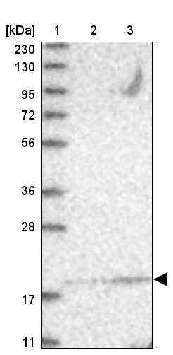 UBE2F/NCE2 Antibody - BSA Free Western Blot: UBE2F/NCE2 Antibody - BSA Free [NBP1-92169]