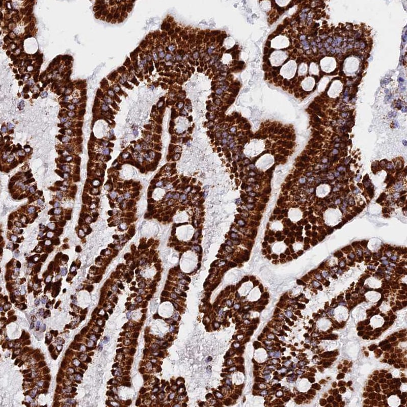 NDUFB6 Antibody - BSA Free Immunohistochemistry: NDUFB6 Antibody - BSA Free [NBP1-92172]