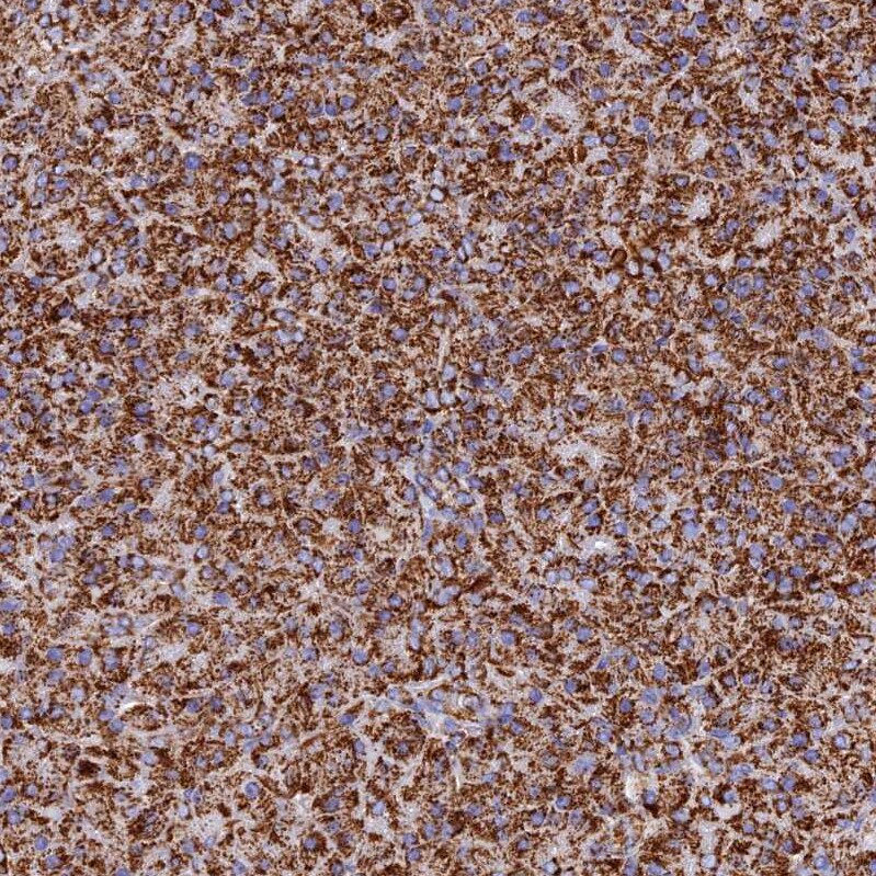 NDUFB6 Antibody - BSA Free Immunohistochemistry: NDUFB6 Antibody - BSA Free [NBP1-92172]