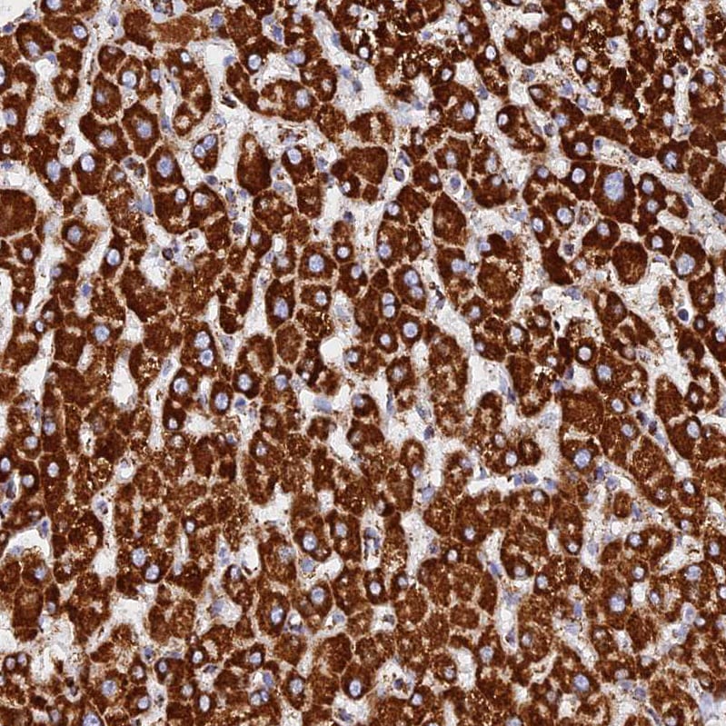 NDUFB6 Antibody - BSA Free Immunohistochemistry: NDUFB6 Antibody - BSA Free [NBP1-92172]