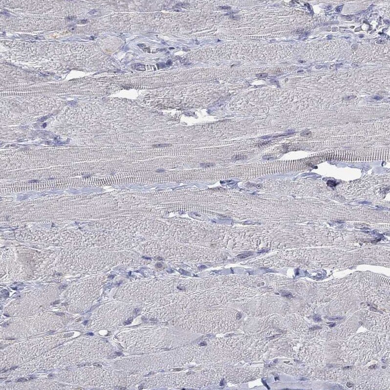 NELF Antibody - BSA Free Immunohistochemistry: NELF Antibody - BSA Free [NBP1-92175]