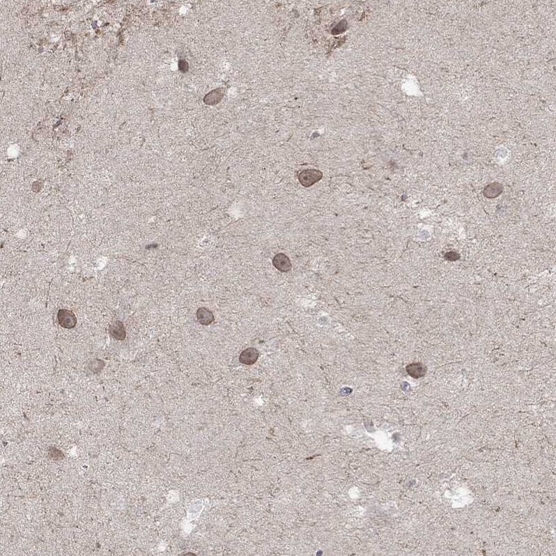NELF Antibody - BSA Free Immunohistochemistry: NELF Antibody - BSA Free [NBP1-92175]