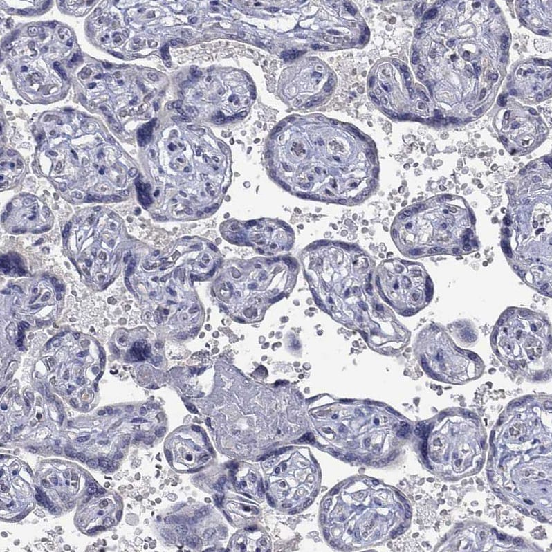 NELF Antibody - BSA Free Immunohistochemistry: NELF Antibody - BSA Free [NBP1-92175]