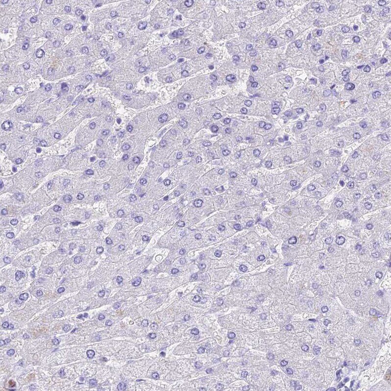 Neurokinin B Antibody - BSA Free Immunohistochemistry: Neurokinin B Antibody - BSA Free [NBP1-92178]
