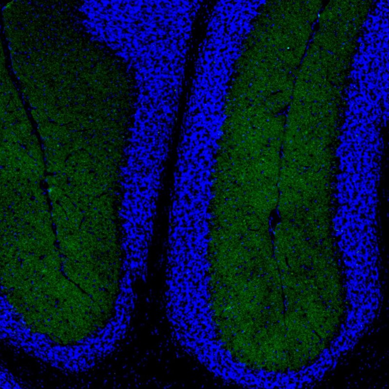 Neurokinin B Antibody - BSA Free Immunohistochemistry: Neurokinin B Antibody - BSA Free [NBP1-92178]