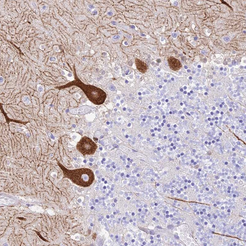Neurokinin B Antibody - BSA Free Immunohistochemistry: Neurokinin B Antibody - BSA Free [NBP1-92178]
