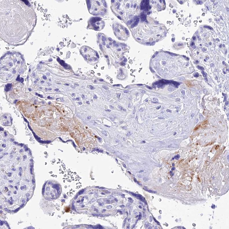 Neurokinin B Antibody - BSA Free Immunohistochemistry: Neurokinin B Antibody - BSA Free [NBP1-92178]