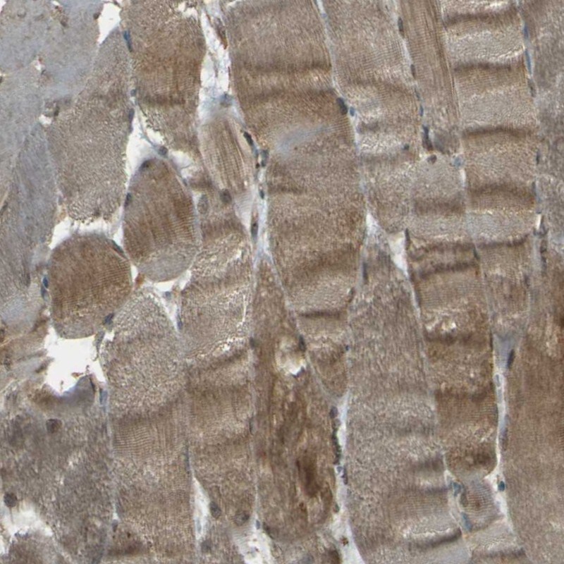 Nexilin Antibody - BSA Free Immunohistochemistry: Nexilin Antibody - BSA Free [NBP1-92179]