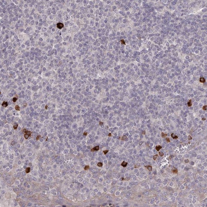 HM74A/PUMA-G/GPR109A/NIACR1 Antibody - BSA Free Immunohistochemistry: HM74A/PUMA-G/GPR109A/NIACR1 Antibody - BSA Free [NBP1-92180]