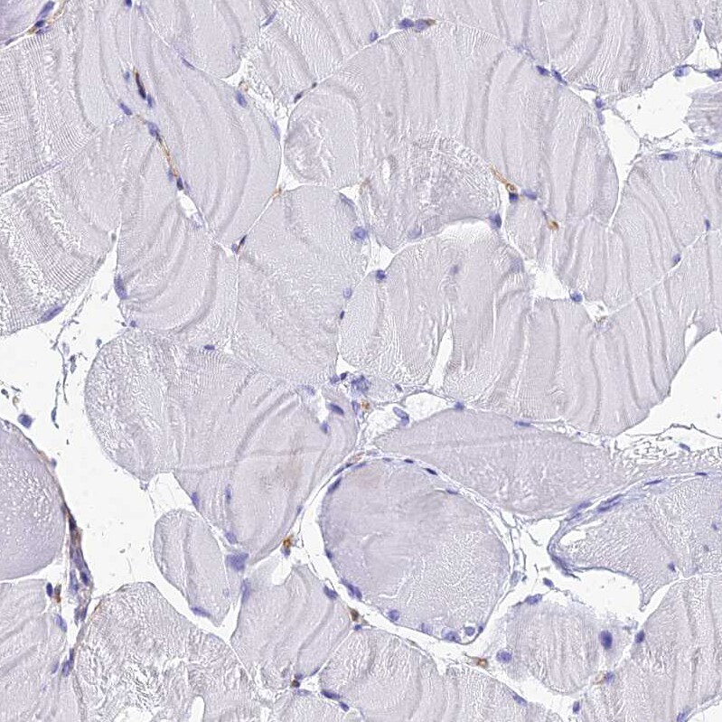 Ninjurin-1 Antibody - BSA Free Immunohistochemistry: Ninjurin-1 Antibody - BSA Free [NBP1-92181]