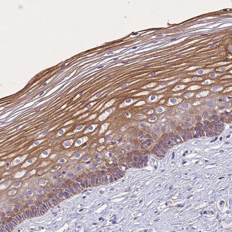 NLRP11 Antibody - BSA Free Immunohistochemistry: NLRP11 Antibody - BSA Free [NBP1-92186]
