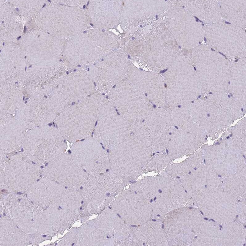 NLRP11 Antibody - BSA Free Immunohistochemistry: NLRP11 Antibody - BSA Free [NBP1-92186]