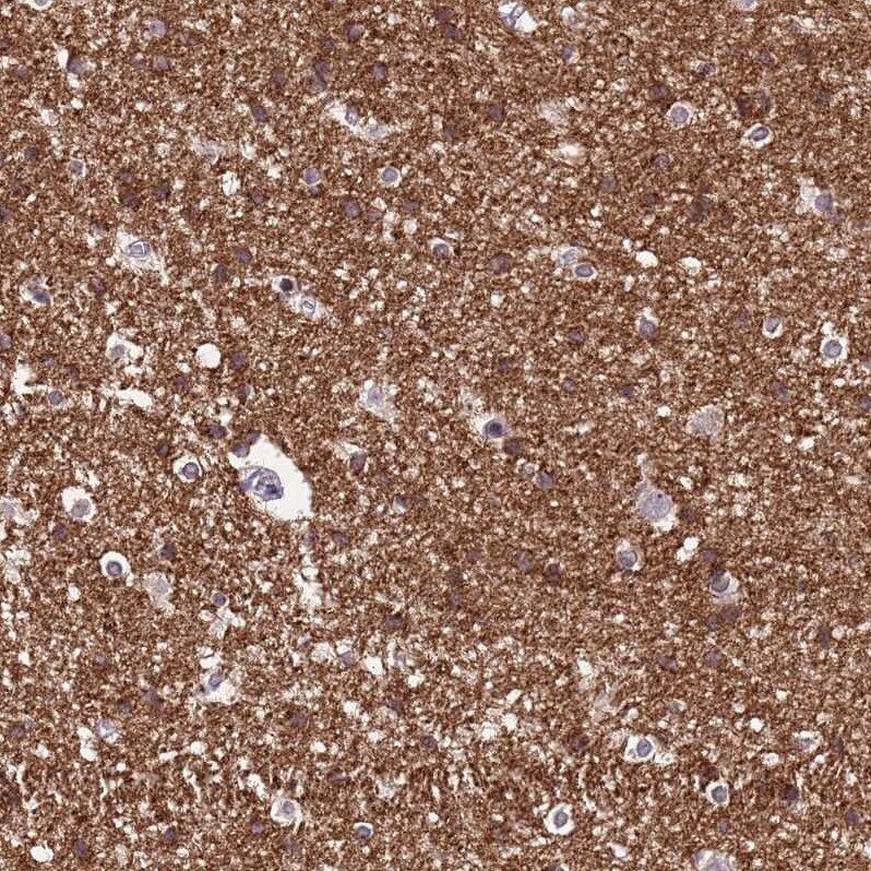 NLRP11 Antibody - BSA Free Immunohistochemistry: NLRP11 Antibody - BSA Free [NBP1-92186]