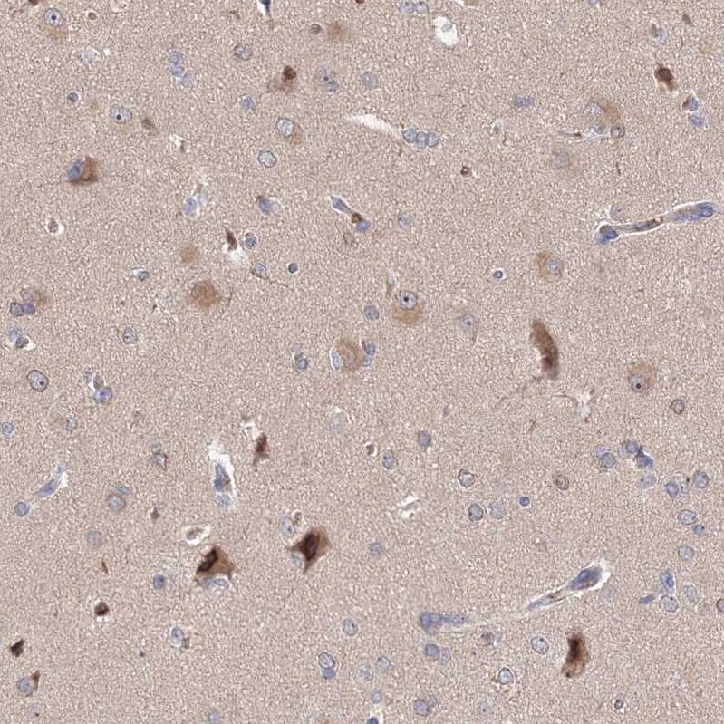 NMDARA1 Antibody - BSA Free Immunohistochemistry: NMDARA1 Antibody - BSA Free [NBP1-92187]