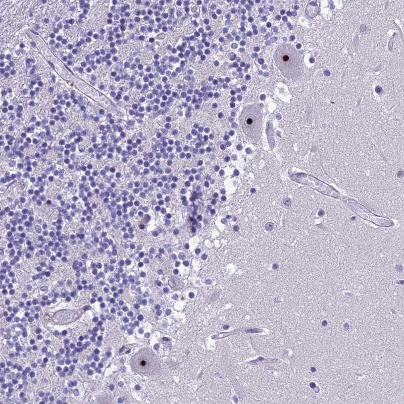 NOC2L Antibody - BSA Free Immunohistochemistry: NOC2L Antibody - BSA Free [NBP1-92190]