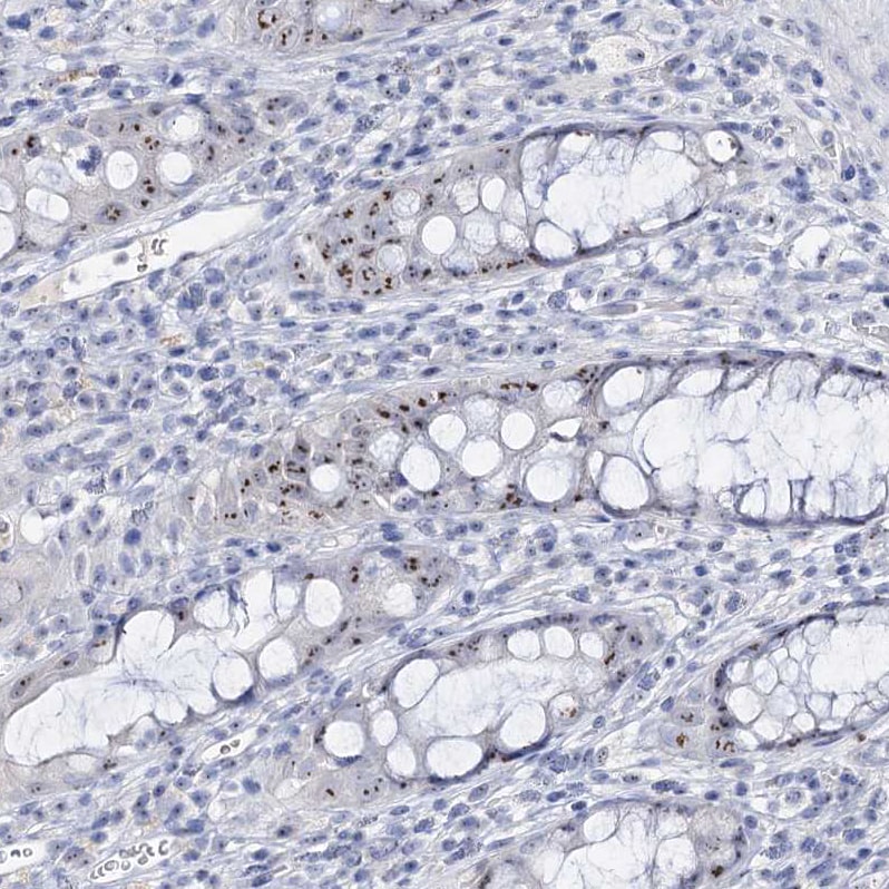 NOL1 Antibody - BSA Free Immunohistochemistry: NOL1 Antibody - BSA Free [NBP1-92192]