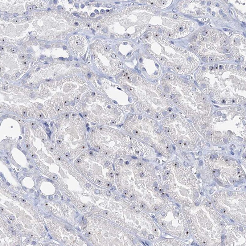 NOL1 Antibody - BSA Free Immunohistochemistry: NOL1 Antibody - BSA Free [NBP1-92192]
