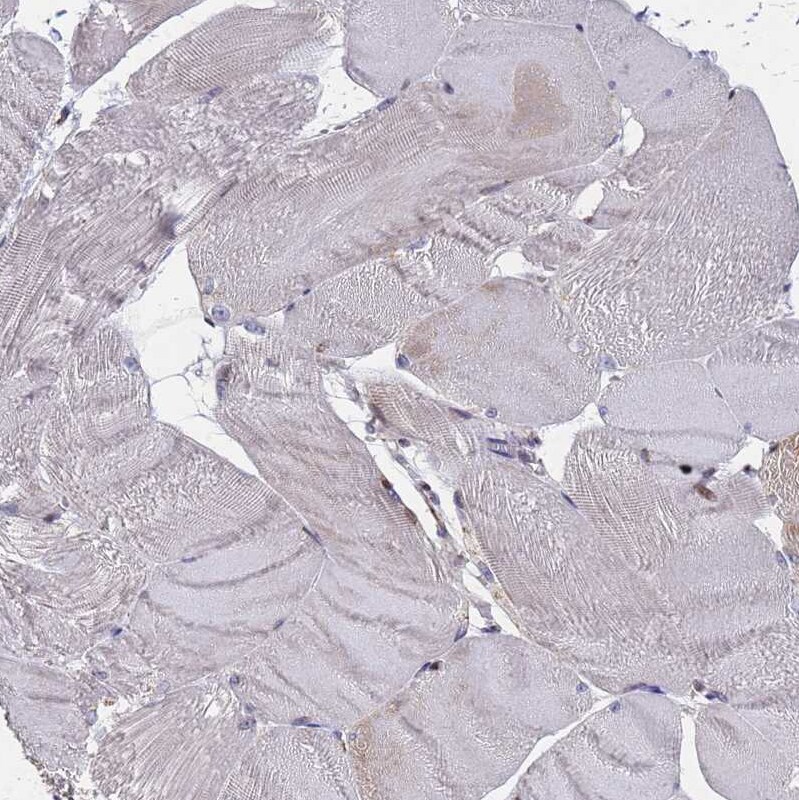 NSUN6 Antibody - BSA Free Immunohistochemistry: NSUN6 Antibody - BSA Free [NBP1-92202]