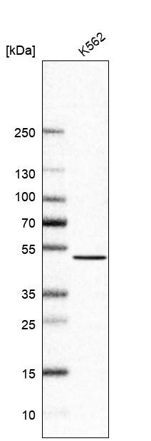 NSUN6 Antibody - BSA Free Western Blot: NSUN6 Antibody - BSA Free [NBP1-92202]