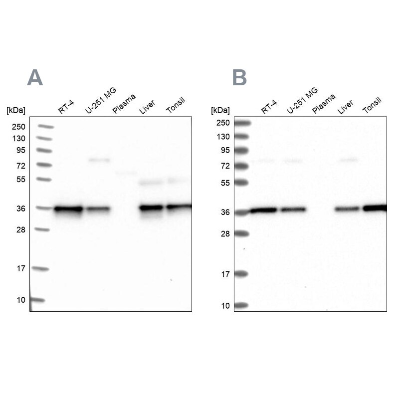 NUBP1 Antibody - BSA Free Western Blot: NUBP1 Antibody - BSA Free [NBP1-92205]