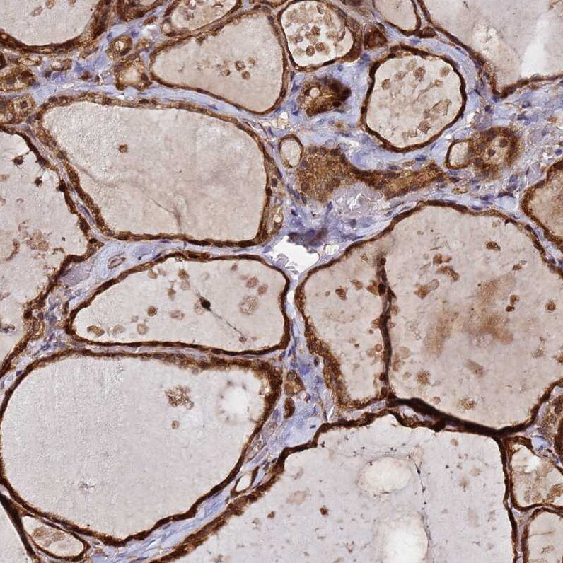 NUDT14 Antibody - BSA Free Immunohistochemistry: NUDT14 Antibody - BSA Free [NBP1-92208]