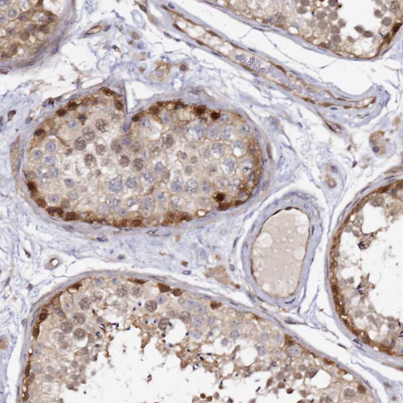 NUDT14 Antibody - BSA Free Immunohistochemistry: NUDT14 Antibody - BSA Free [NBP1-92208]