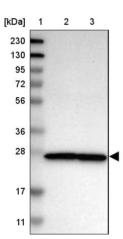 Nup53 Antibody - BSA Free Western Blot: Nup53 Antibody - BSA Free [NBP1-92212]