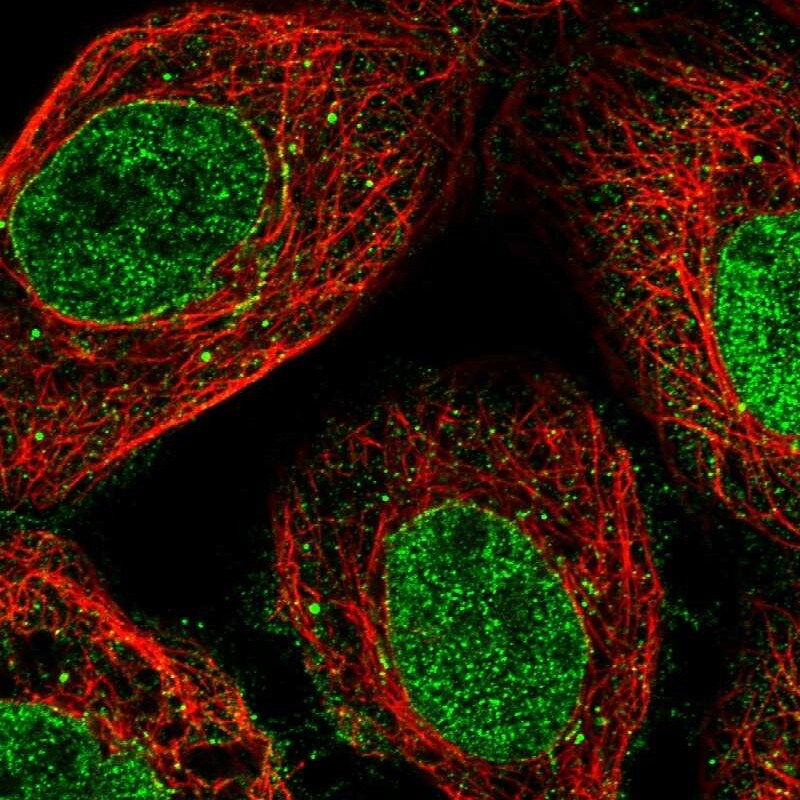 Nup53 Antibody - BSA Free Immunocytochemistry/ Immunofluorescence: Nup53 Antibody [NBP1-92214]