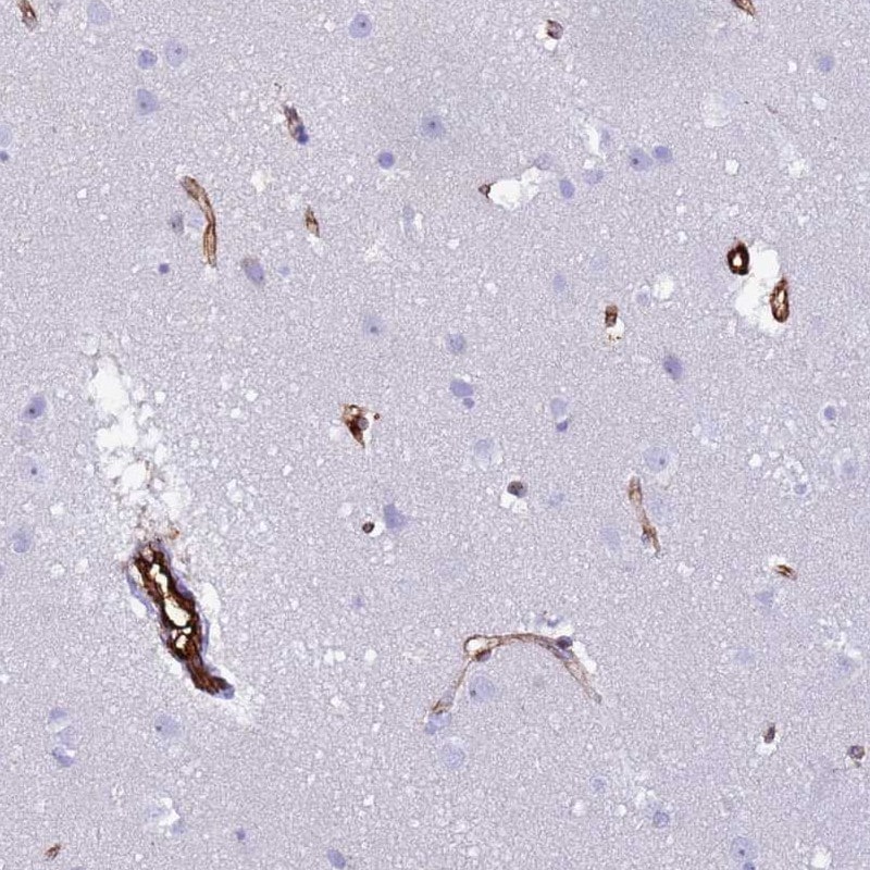Neurexophilin-1 Antibody - BSA Free Immunohistochemistry: Neurexophilin-1 Antibody - BSA Free [NBP1-92216]