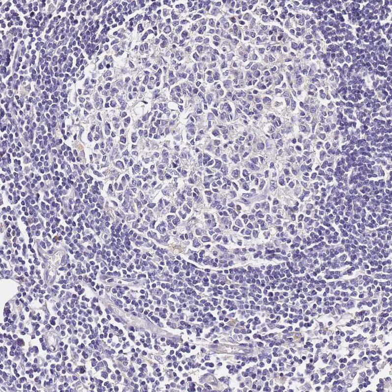 OR2B11 Antibody - BSA Free Immunohistochemistry: OR2B11 Antibody - BSA Free [NBP1-92225]