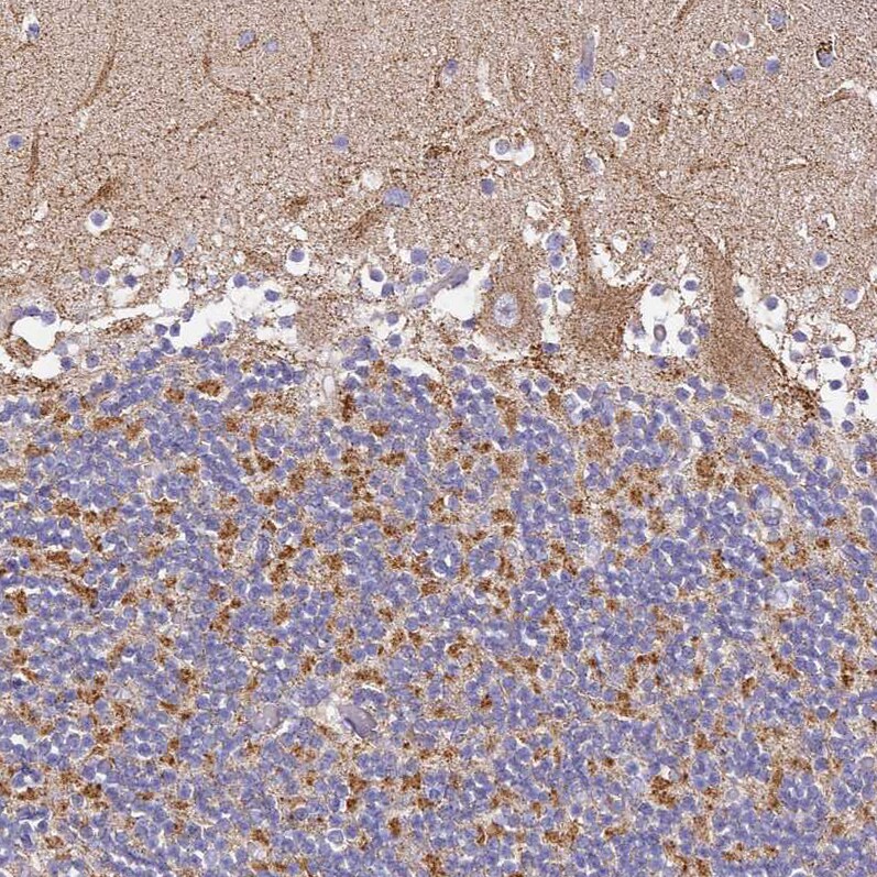 OR2B11 Antibody - BSA Free Immunohistochemistry: OR2B11 Antibody - BSA Free [NBP1-92225]